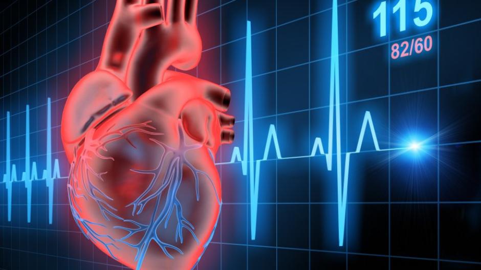 Arythmie cardiaque : causes, symptômes et traitements