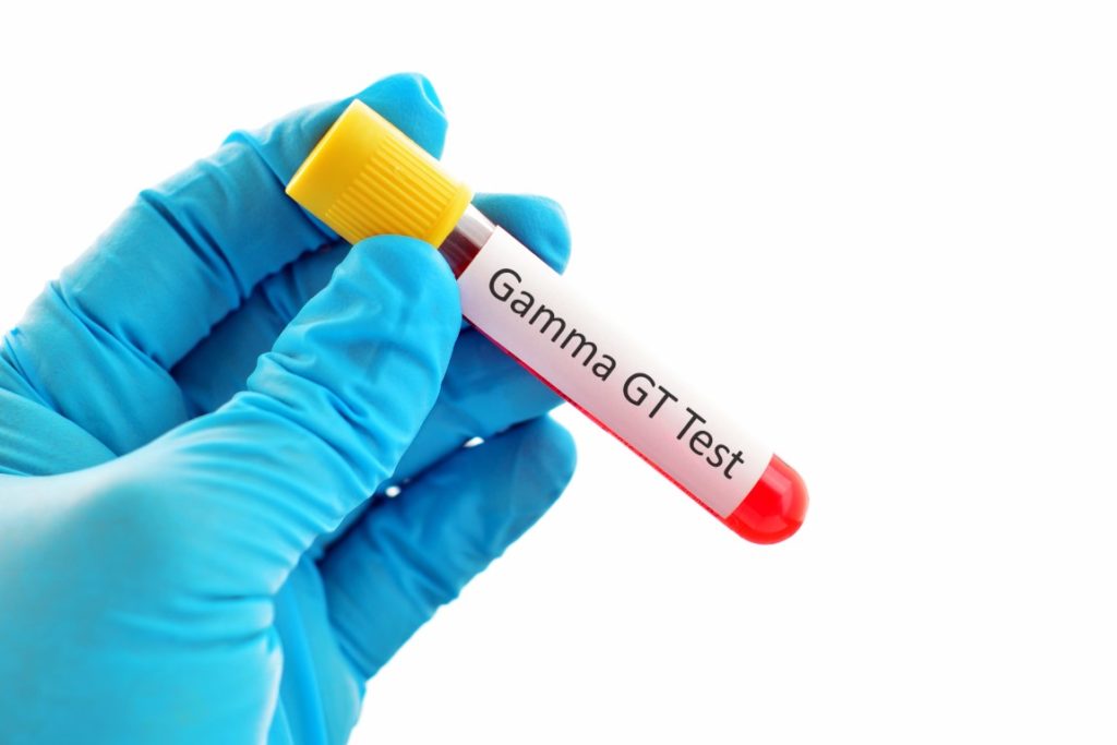 Remède de grand-mère pour faire baisser les Gamma GT