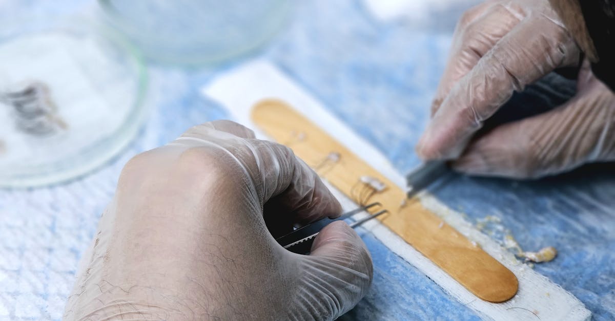Comment faire de la chirurgie esthétique gratuitement : astuces à connaître.