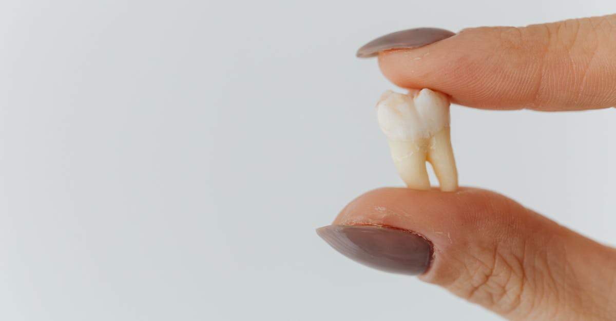 Déchaussement des dents : quels sont les traitements chirurgicaux ?