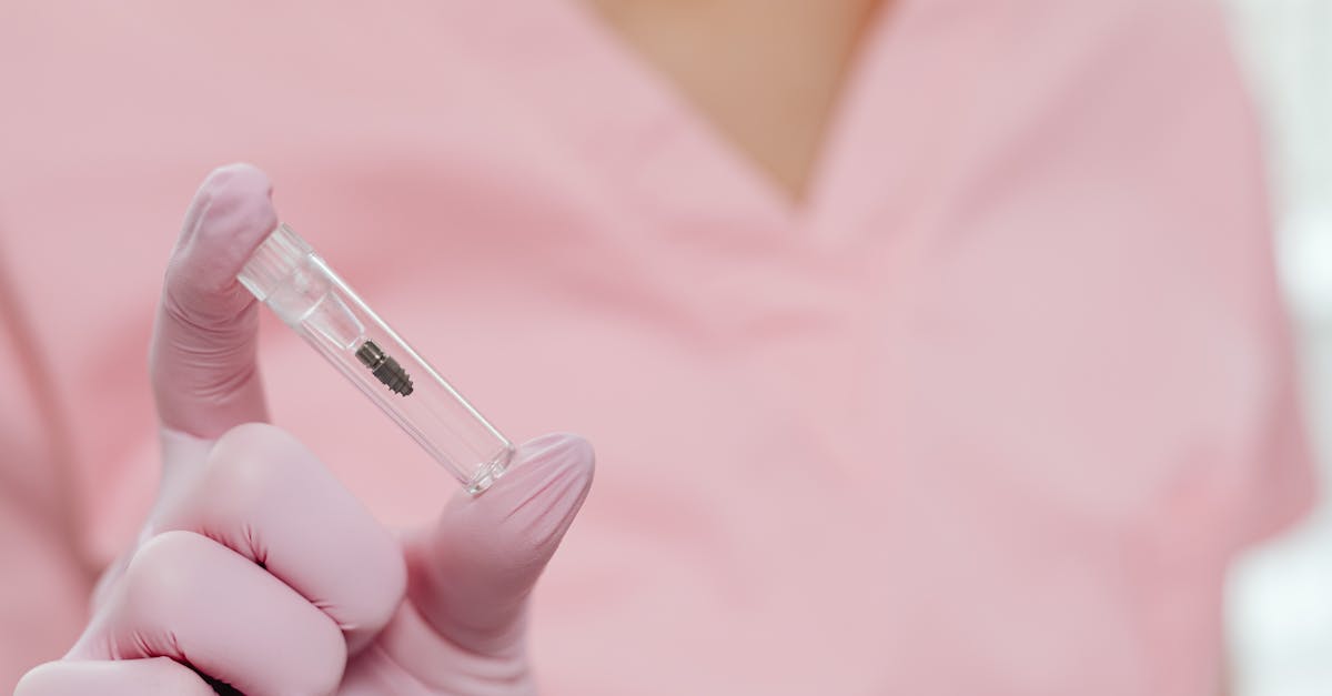 Rejet d’implants dentaires : les signes à reconnaître.